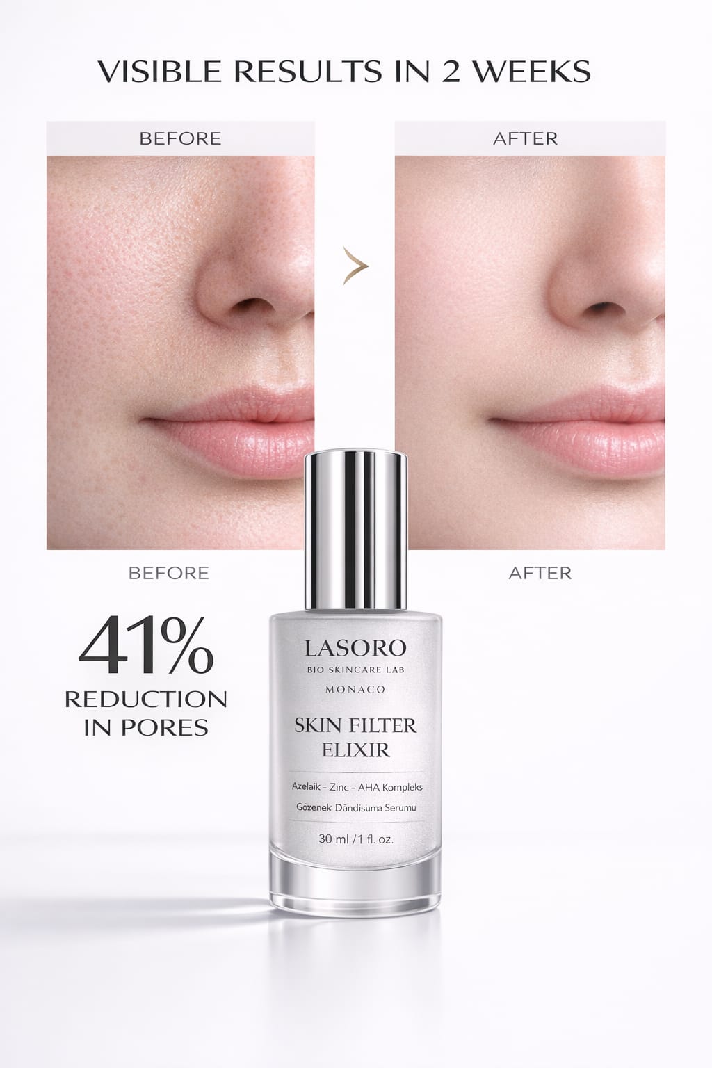 Skin Filter Gozenek Gideren Serum Azelaik asit Glikolik asit , Laktik asit Salisilik asit